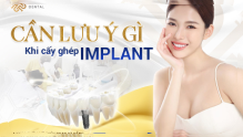 Quỳnh Trần JP về Việt Nam trồng răng Implant tại Thủy Phan Dental